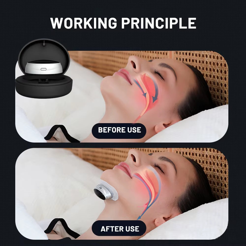 Smart Anti-Snoring Device Breathing Corrector Electric anti Snoring Sleep Pro Smart EMS anti Snoring Device